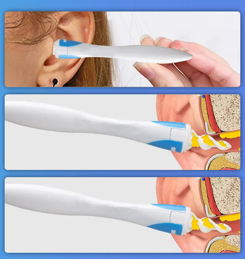 Spiral Ear Plucker