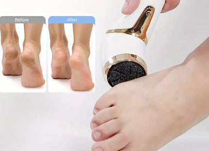 Electric Callus Remover For Feet