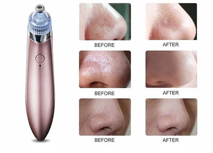 Electric Blackhead Vacuum
