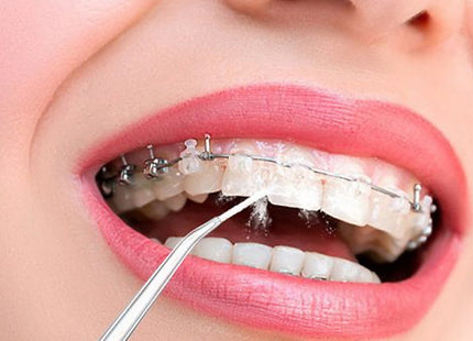 Dental Water Jet