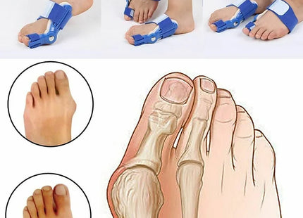 Orthopaedic Foot Bunion Correctors Pair