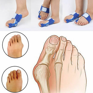 Orthopaedic Foot Bunion Correctors Pair