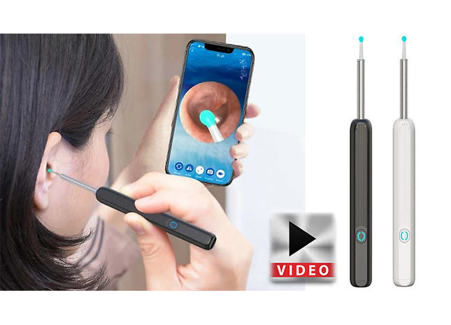 WiFi-Enabled Visible Ear Wax Removal Kit