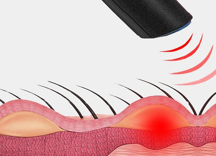 Portable Electronic Insect Bite Reliever